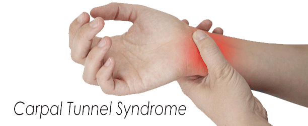 Carpal Tunnel - Summit Chiropractic LLC